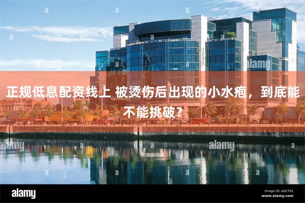 正规低息配资线上 被烫伤后出现的小水疱，到底能不能挑破？